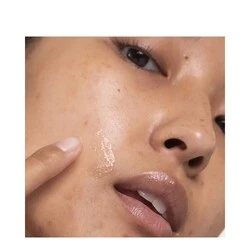 Dr Dennis Gross DRx Acne Eliminating Gel 2 Dr Dennis Gross DRx Acne Eliminating Gel - Image 2