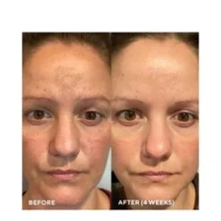 HydroPeptide Firma-Bright 20% Vitamin C Booster 6 HydroPeptide Firma-Bright 20% Vitamin C Booster -Rene Care Shop Firma Bright 20 Vitamin C Booster add2 70291 7145 general